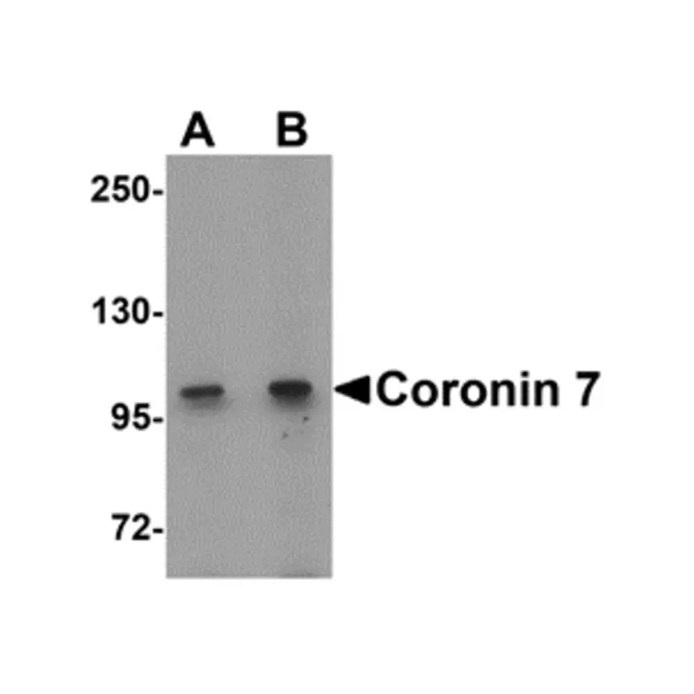 ProSci 6451 Coronin 7 Antibody, ProSci, 0.1 mg/Unit Primary Image