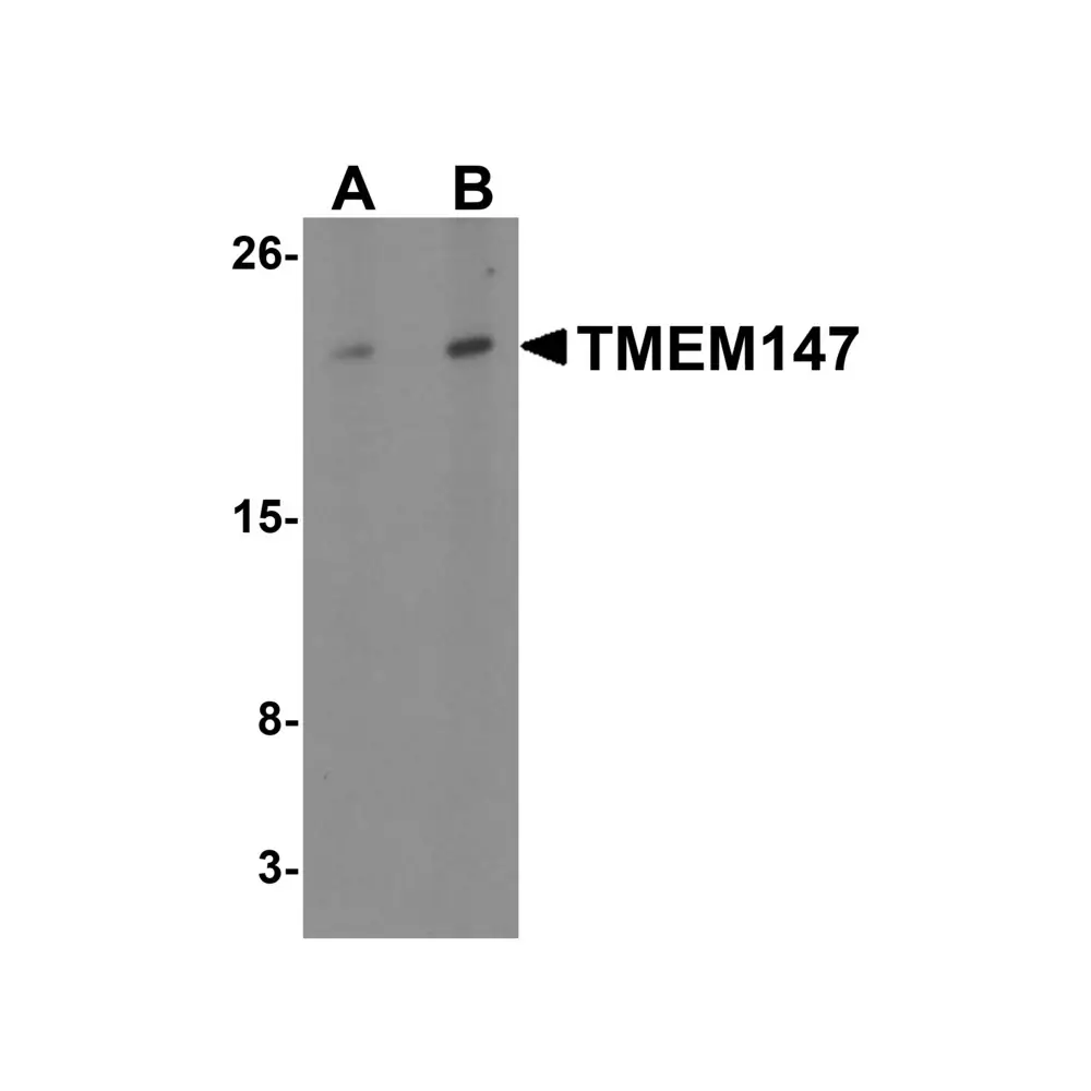 ProSci 6453_S TMEM147 Antibody, ProSci, 0.02 mg/Unit Primary Image