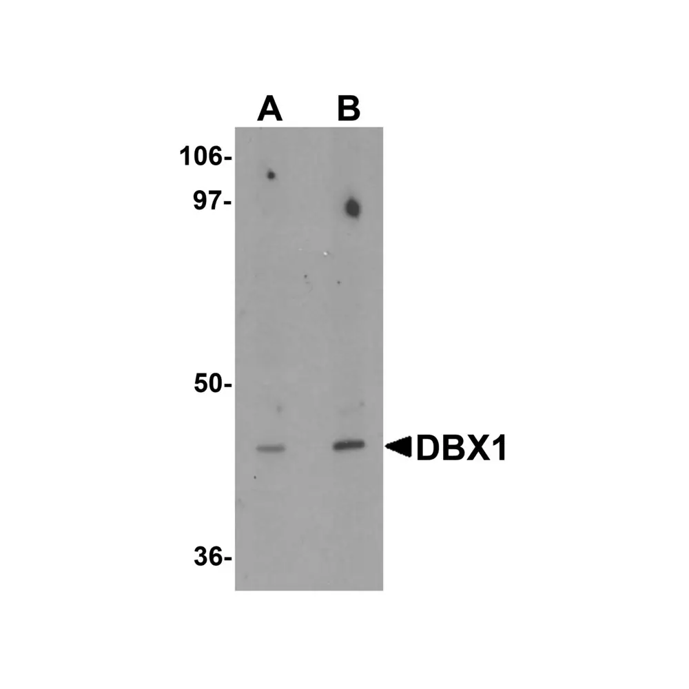 ProSci 6455 DBX1 Antibody, ProSci, 0.1 mg/Unit Primary Image