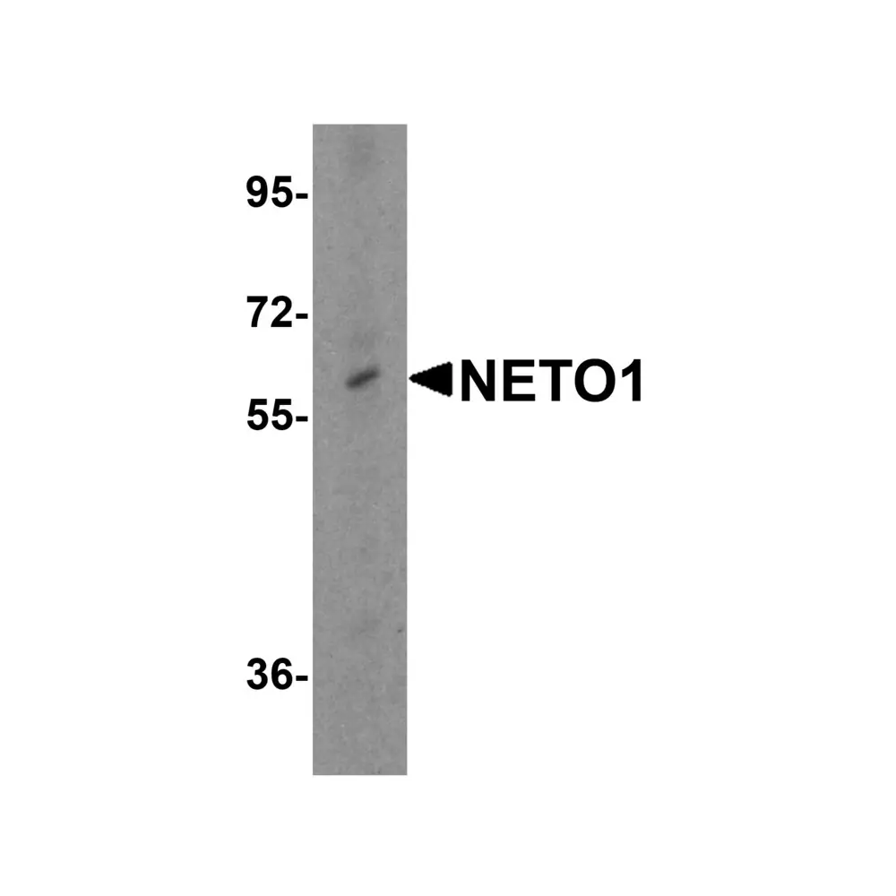 ProSci 6469 NETO1 Antibody, ProSci, 0.1 mg/Unit Primary Image