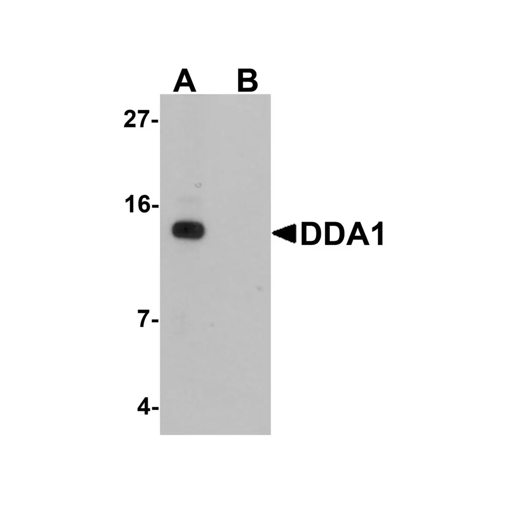 ProSci 6483_S DDA Antibody, ProSci, 0.02 mg/Unit Primary Image
