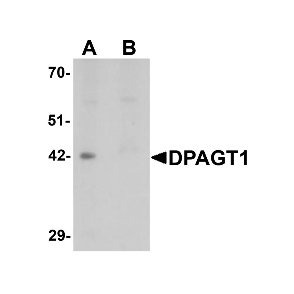 ProSci 6485 DPAGT1 Antibody, ProSci, 0.1 mg/Unit Primary Image