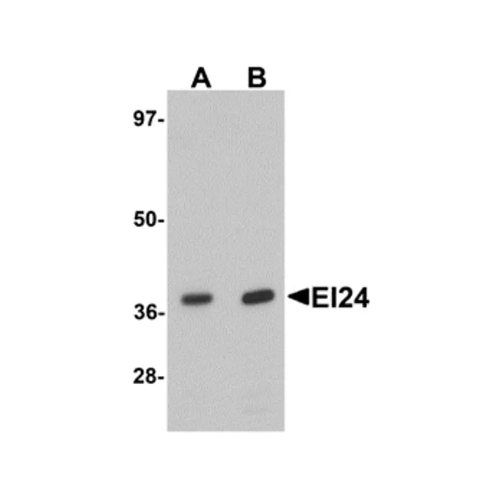 ProSci 6487_S EI24 Antibody, ProSci, 0.02 mg/Unit Primary Image