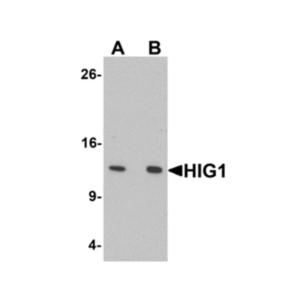 ProSci 6489 HIG1 Antibody, ProSci, 0.1 mg/Unit Primary Image