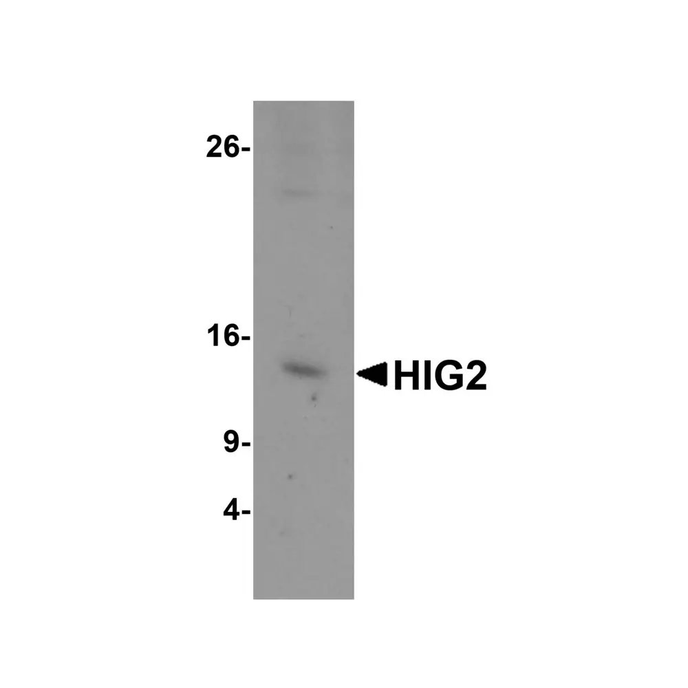 ProSci 6491_S HIG2 Antibody, ProSci, 0.02 mg/Unit Primary Image