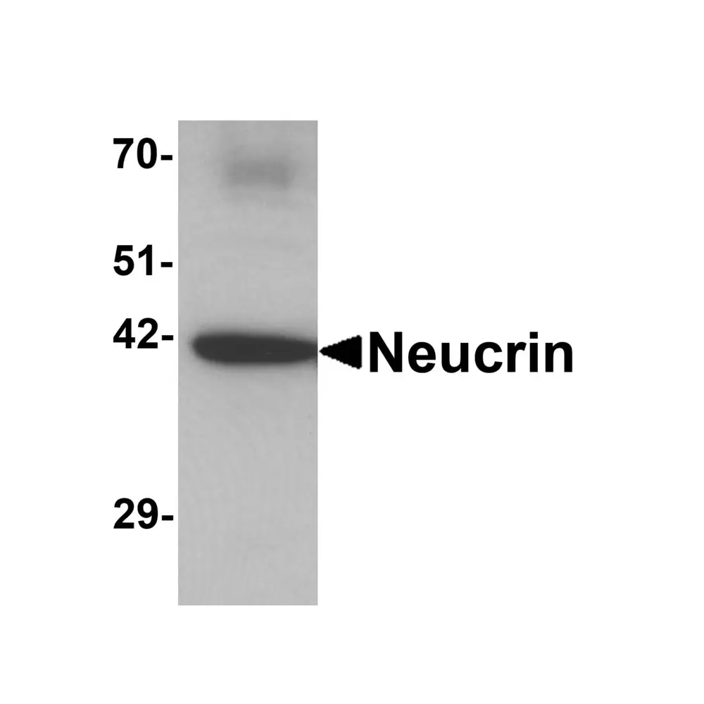 ProSci 6493 NEUCRIN Antibody, ProSci, 0.1 mg/Unit Primary Image