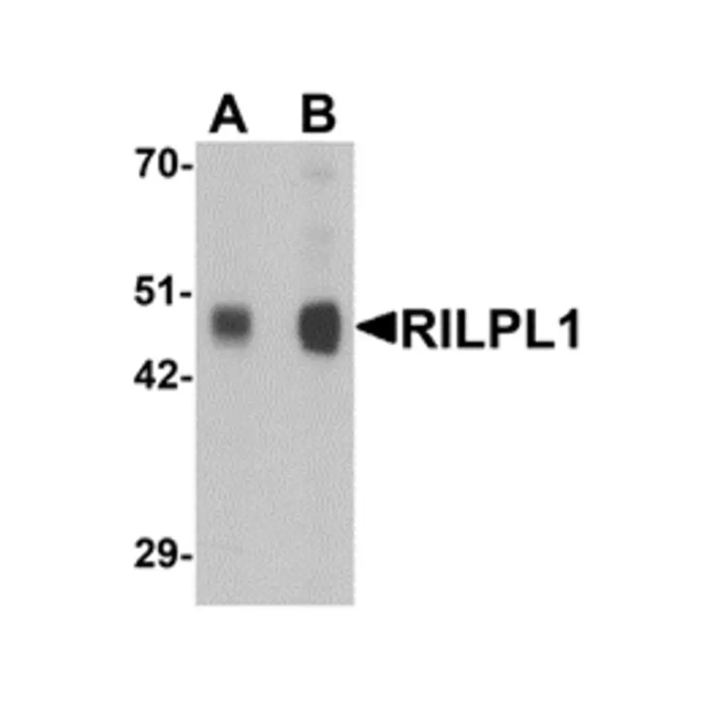 ProSci 6495 RILPL1 Antibody, ProSci, 0.1 mg/Unit Primary Image