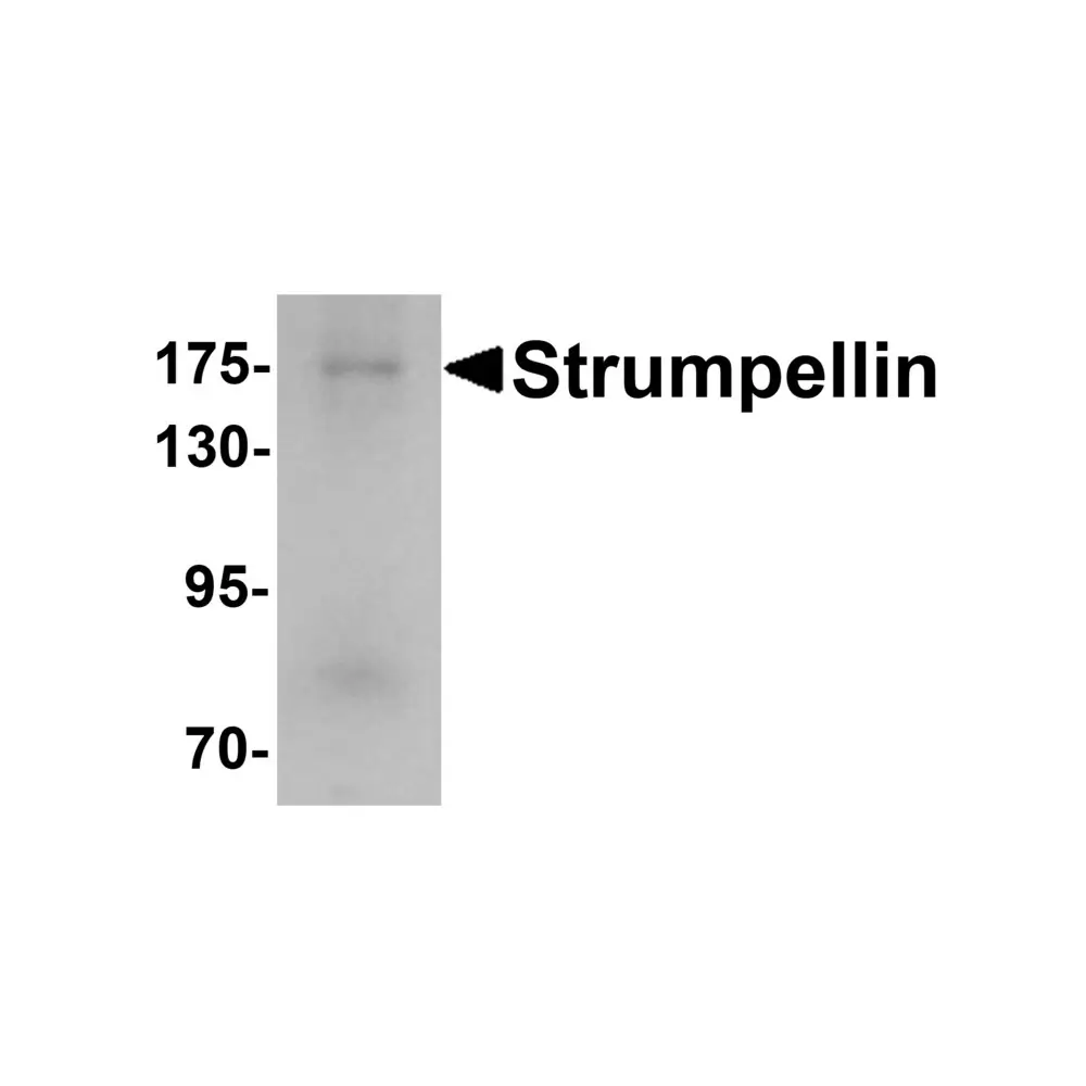 ProSci 6497_S Strumpellin Antibody, ProSci, 0.02 mg/Unit Primary Image