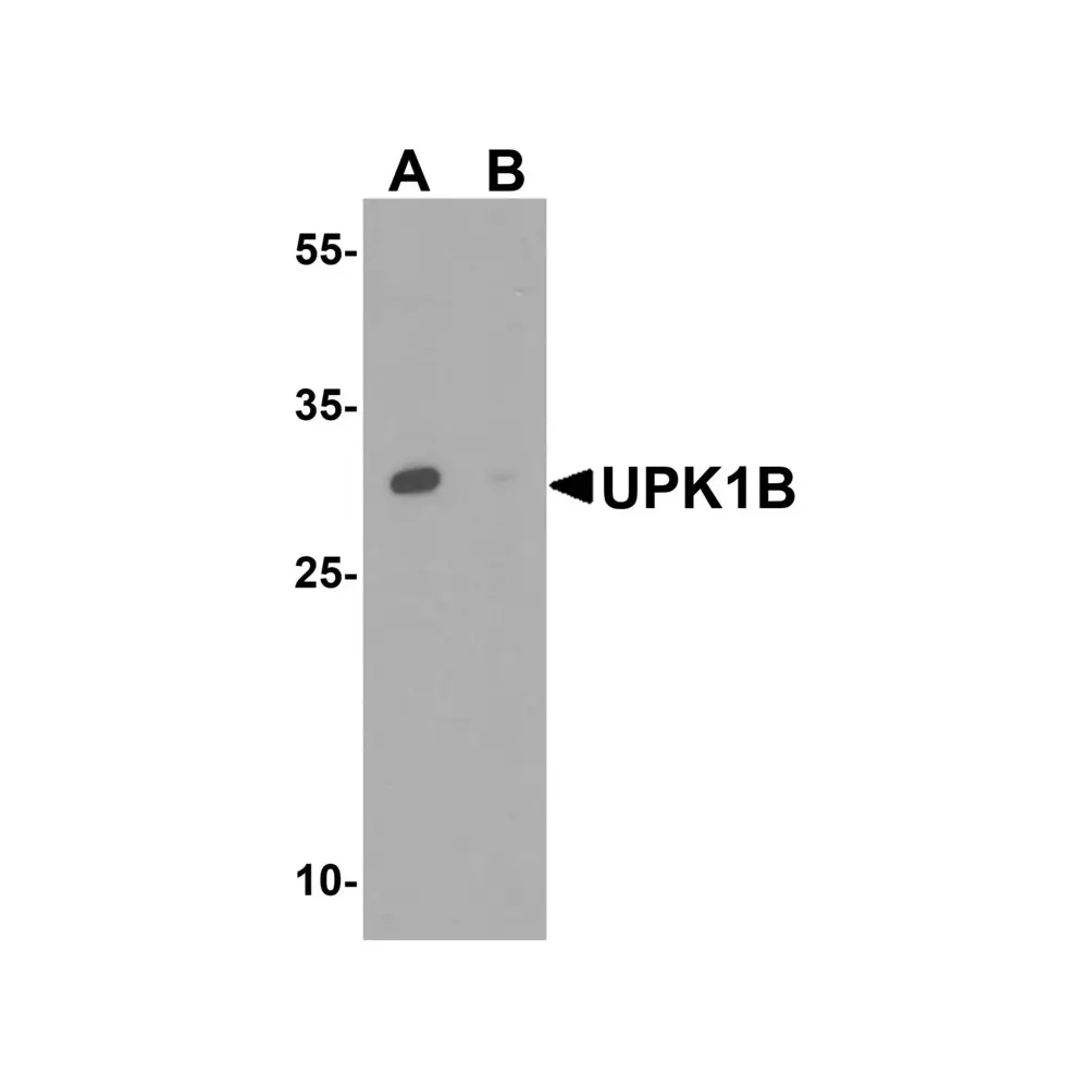 ProSci 6499 UPK1B Antibody, ProSci, 0.1 mg/Unit Primary Image