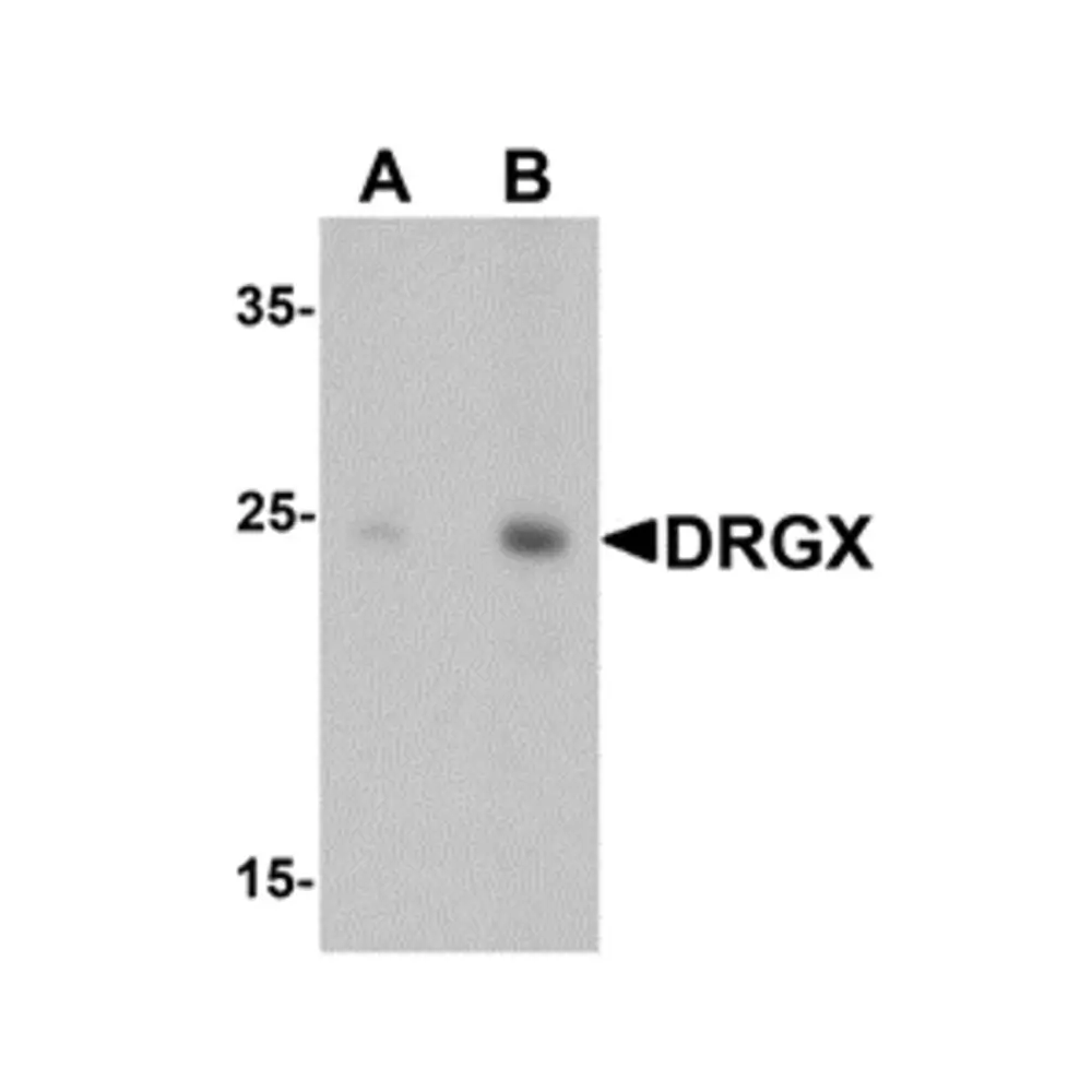 ProSci 6517 DRGX Antibody, ProSci, 0.1 mg/Unit Primary Image
