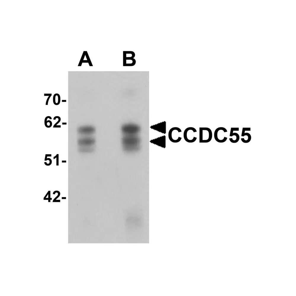 ProSci 6519_S CCDC55 Antibody, ProSci, 0.02 mg/Unit Primary Image