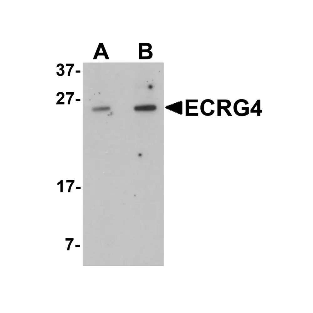 ProSci 6535_S ECRG4 Antibody, ProSci, 0.02 mg/Unit Primary Image