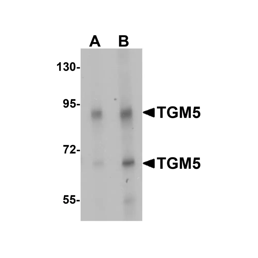 ProSci 6537 TGM5 Antibody, ProSci, 0.1 mg/Unit Primary Image