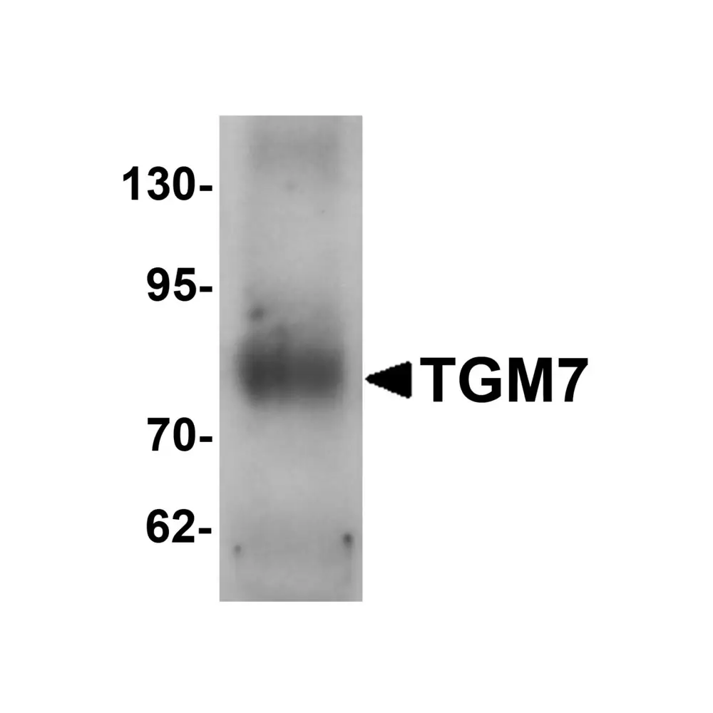 ProSci 6541 TGM7 Antibody, ProSci, 0.1 mg/Unit Primary Image
