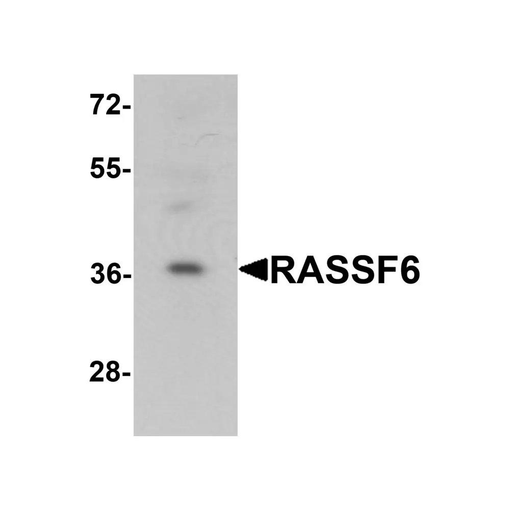 ProSci 6543_S RASSF6 Antibody, ProSci, 0.02 mg/Unit Primary Image