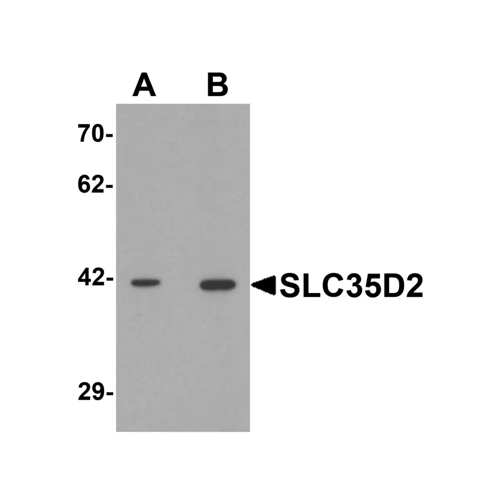 ProSci 6545_S SLC35D2 Antibody, ProSci, 0.02 mg/Unit Primary Image