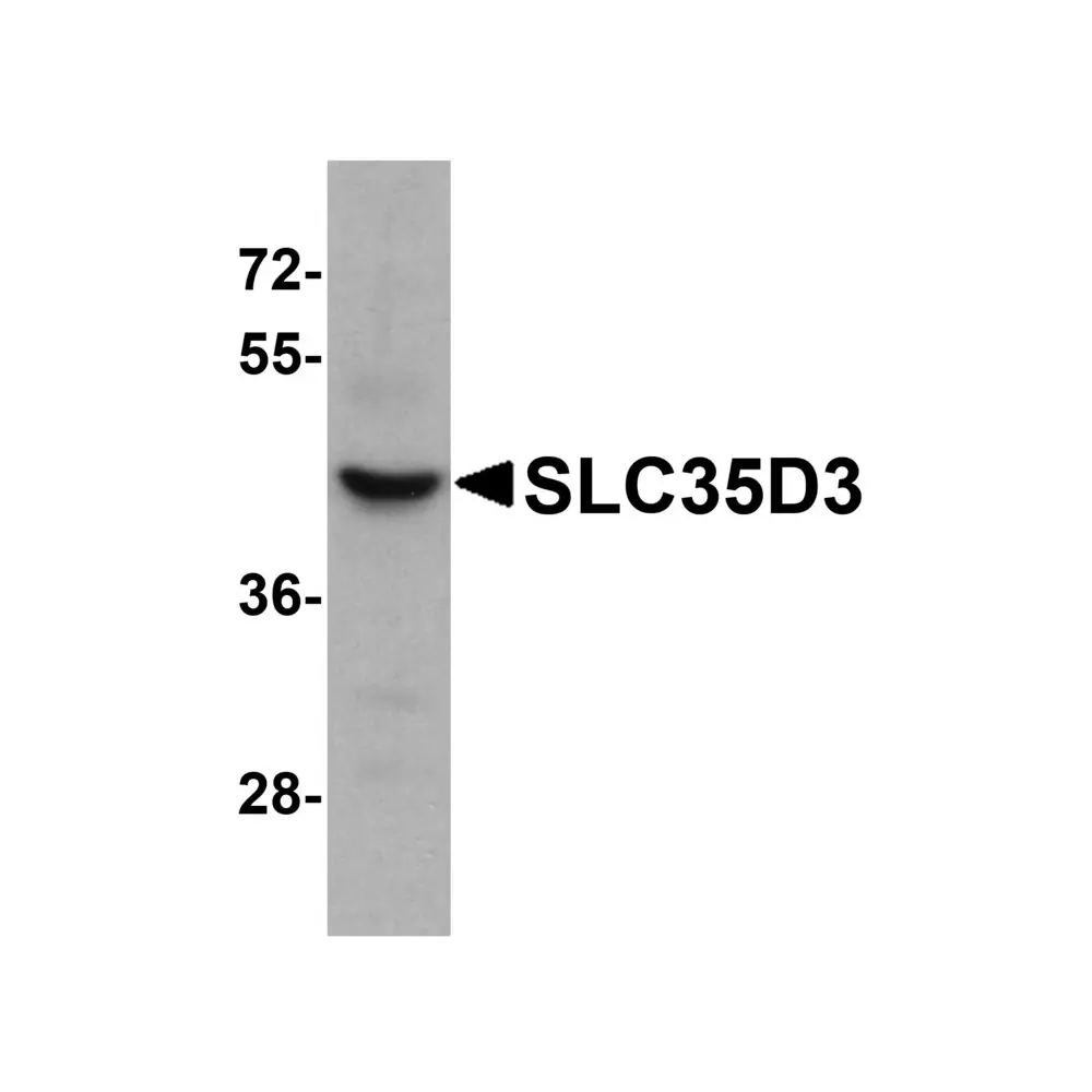 ProSci 6547_S SLC35D3 Antibody, ProSci, 0.02 mg/Unit Primary Image