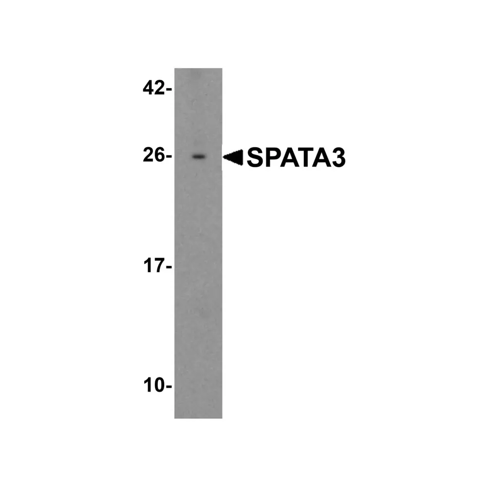 ProSci 6551 SPATA3 Antibody, ProSci, 0.1 mg/Unit Primary Image