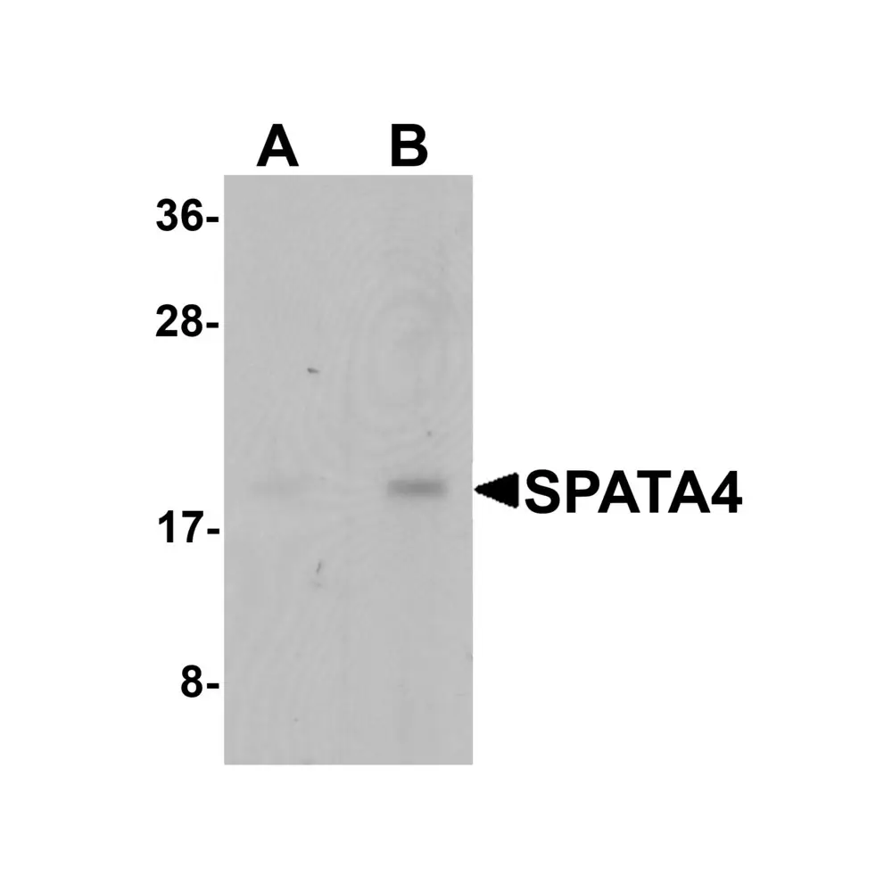 ProSci 6553_S SPATA4 Antibody, ProSci, 0.02 mg/Unit Primary Image