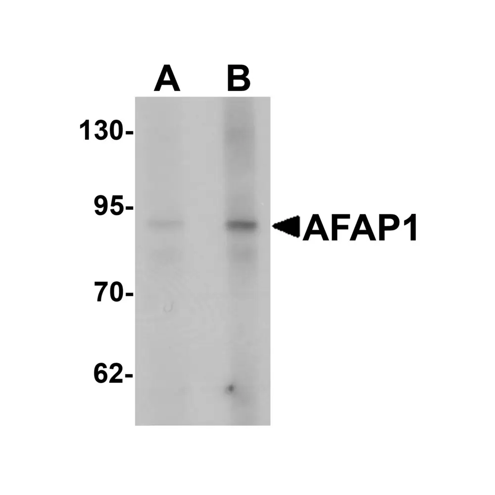 ProSci 6557 AFAP1 Antibody, ProSci, 0.1 mg/Unit Primary Image