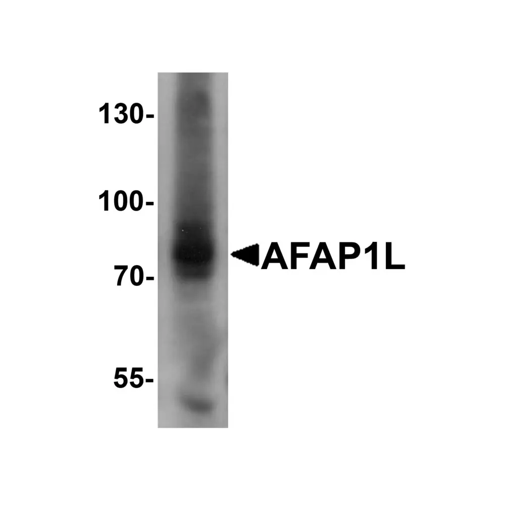 ProSci 6559 AFAP1L Antibody, ProSci, 0.1 mg/Unit Primary Image