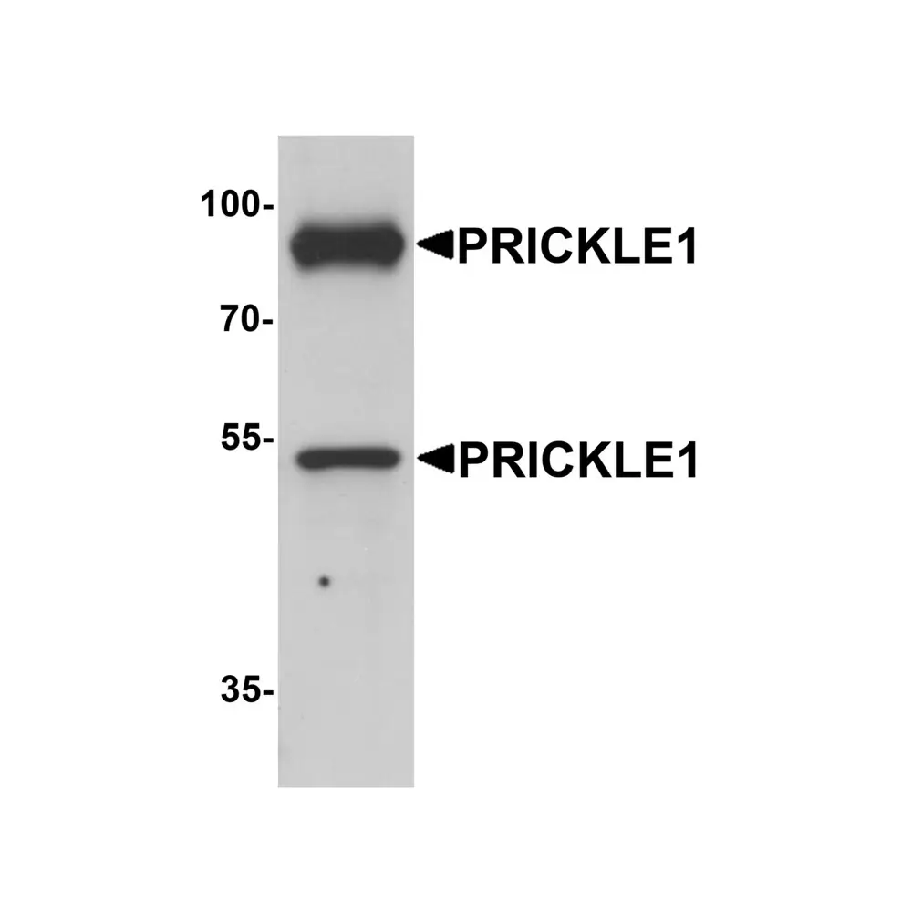 ProSci 6561 PRICKLE1 Antibody, ProSci, 0.1 mg/Unit Primary Image