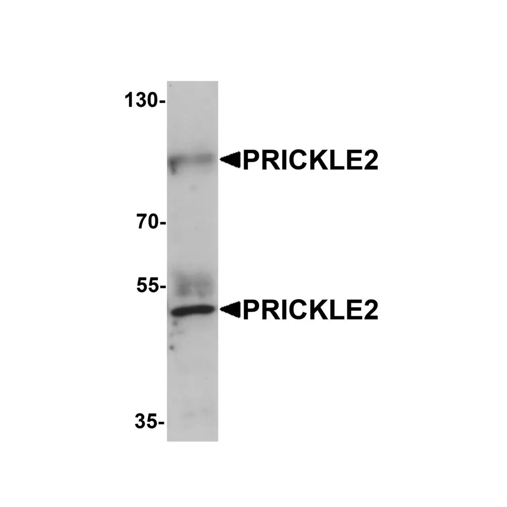 ProSci 6563 PRICKLE2 Antibody, ProSci, 0.1 mg/Unit Primary Image
