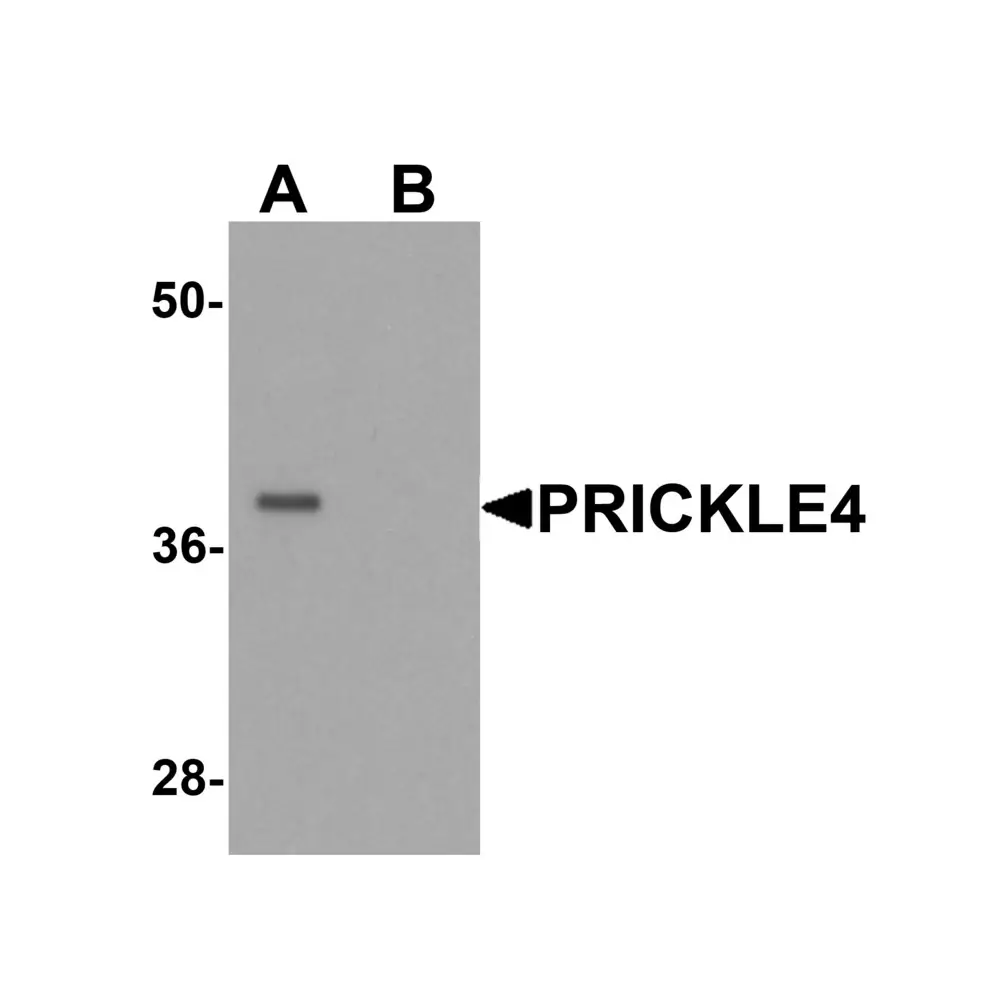 ProSci 6567 PRICKLE4 Antibody, ProSci, 0.1 mg/Unit Primary Image