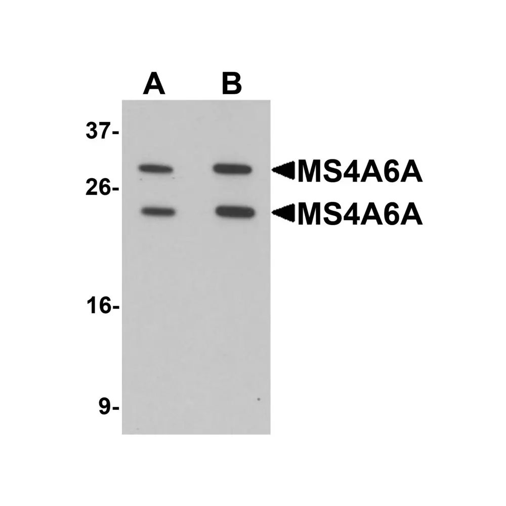 ProSci 6593_S MS4A6A Antibody, ProSci, 0.02 mg/Unit Primary Image