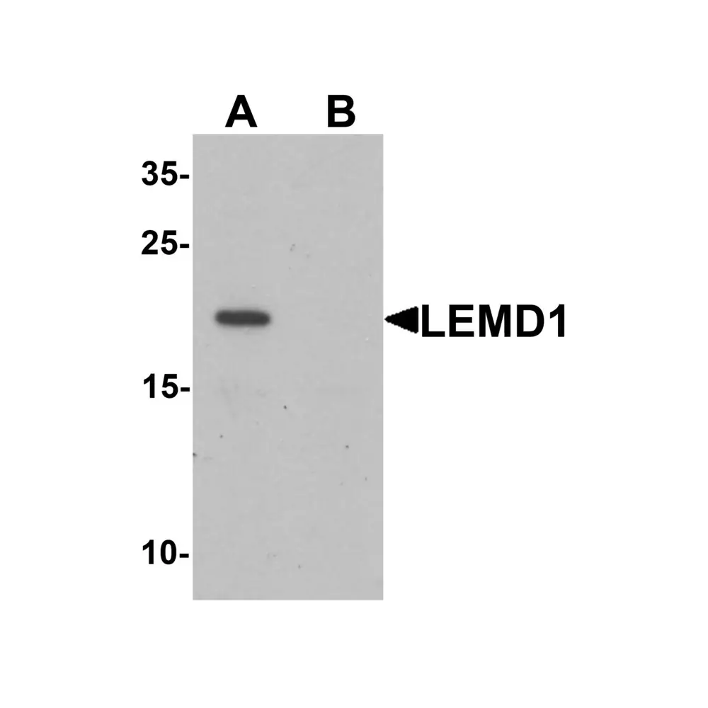 ProSci 6599 LEMD1 Antibody, ProSci, 0.1 mg/Unit Primary Image