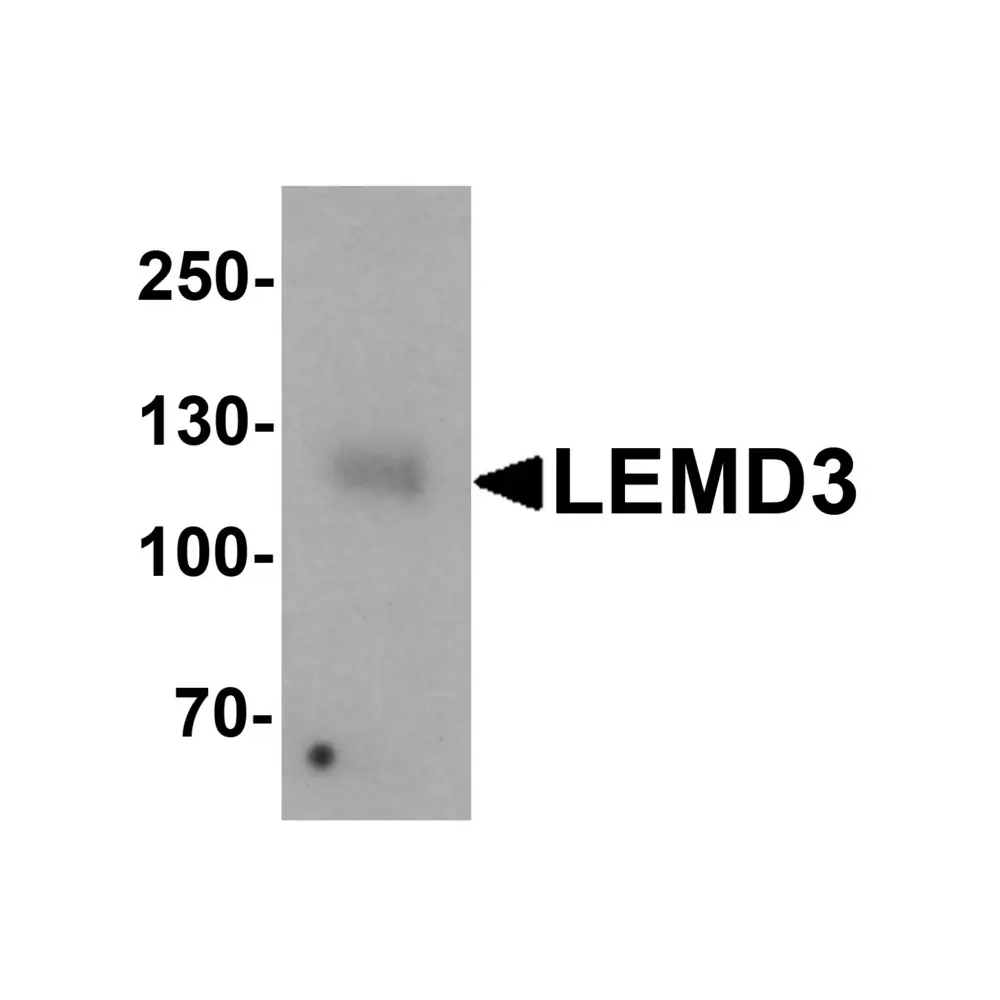 ProSci 6603 LEMD3 Antibody, ProSci, 0.1 mg/Unit Primary Image