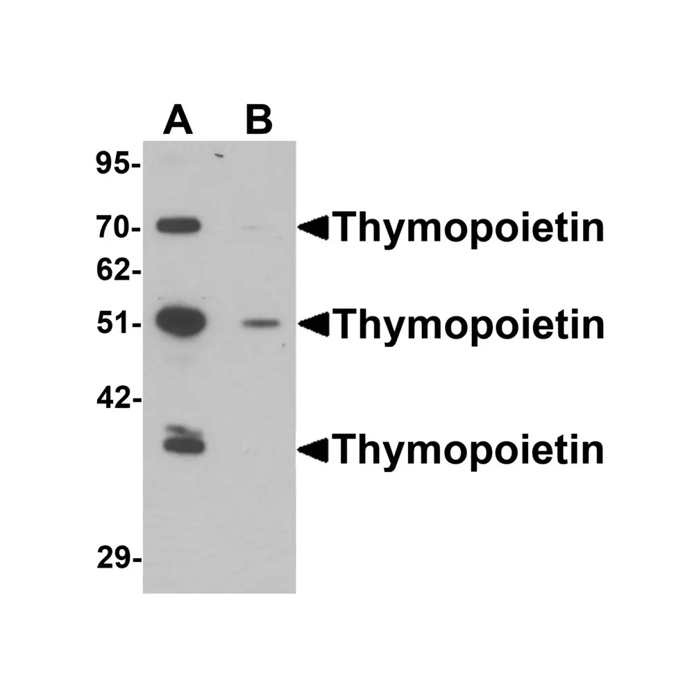 ProSci 6605_S Thymopoietin Antibody, ProSci, 0.02 mg/Unit Primary Image