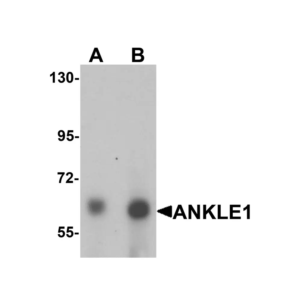 ProSci 6607 ANKLE1 Antibody, ProSci, 0.1 mg/Unit Primary Image