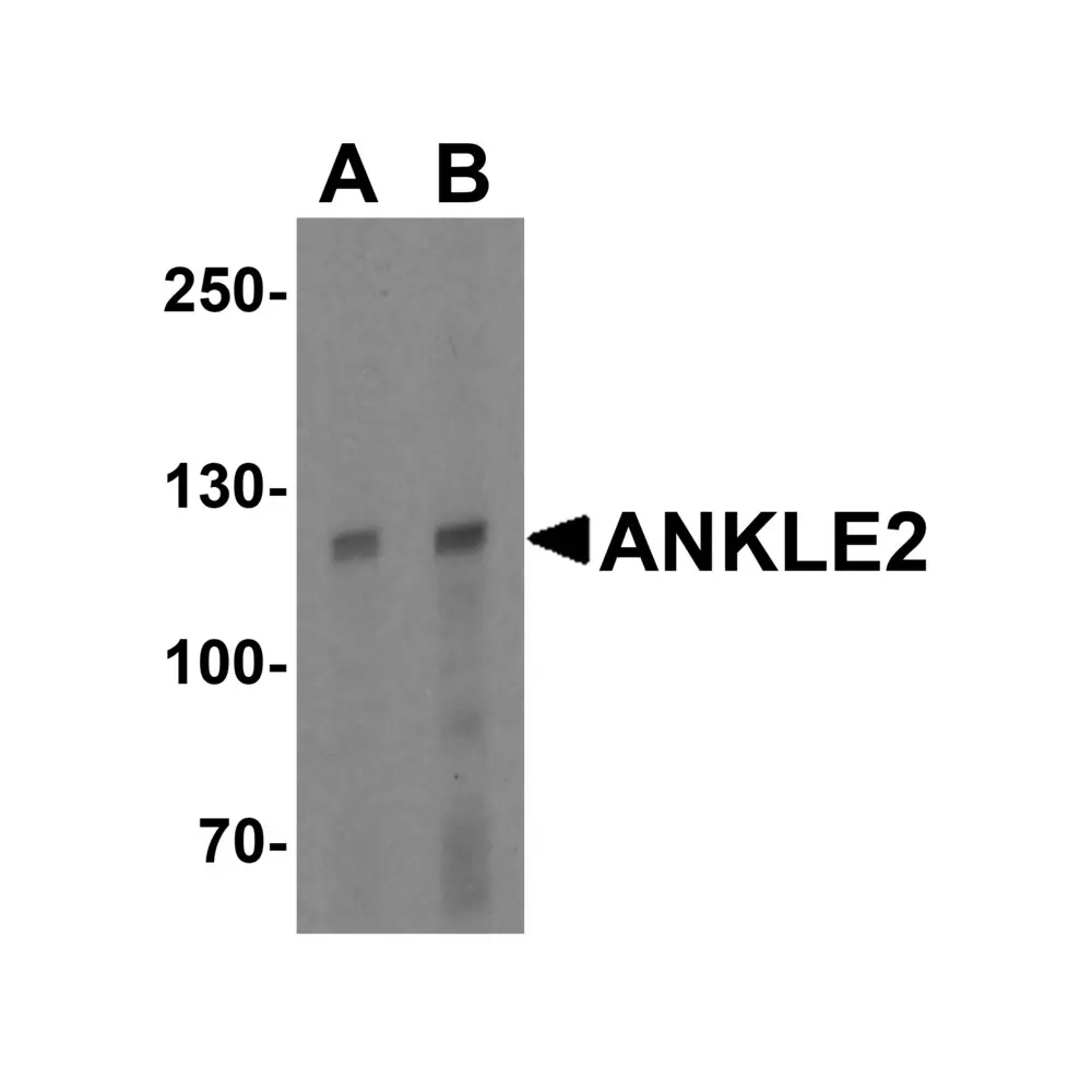 ProSci 6609 ANKLE2 Antibody, ProSci, 0.1 mg/Unit Primary Image