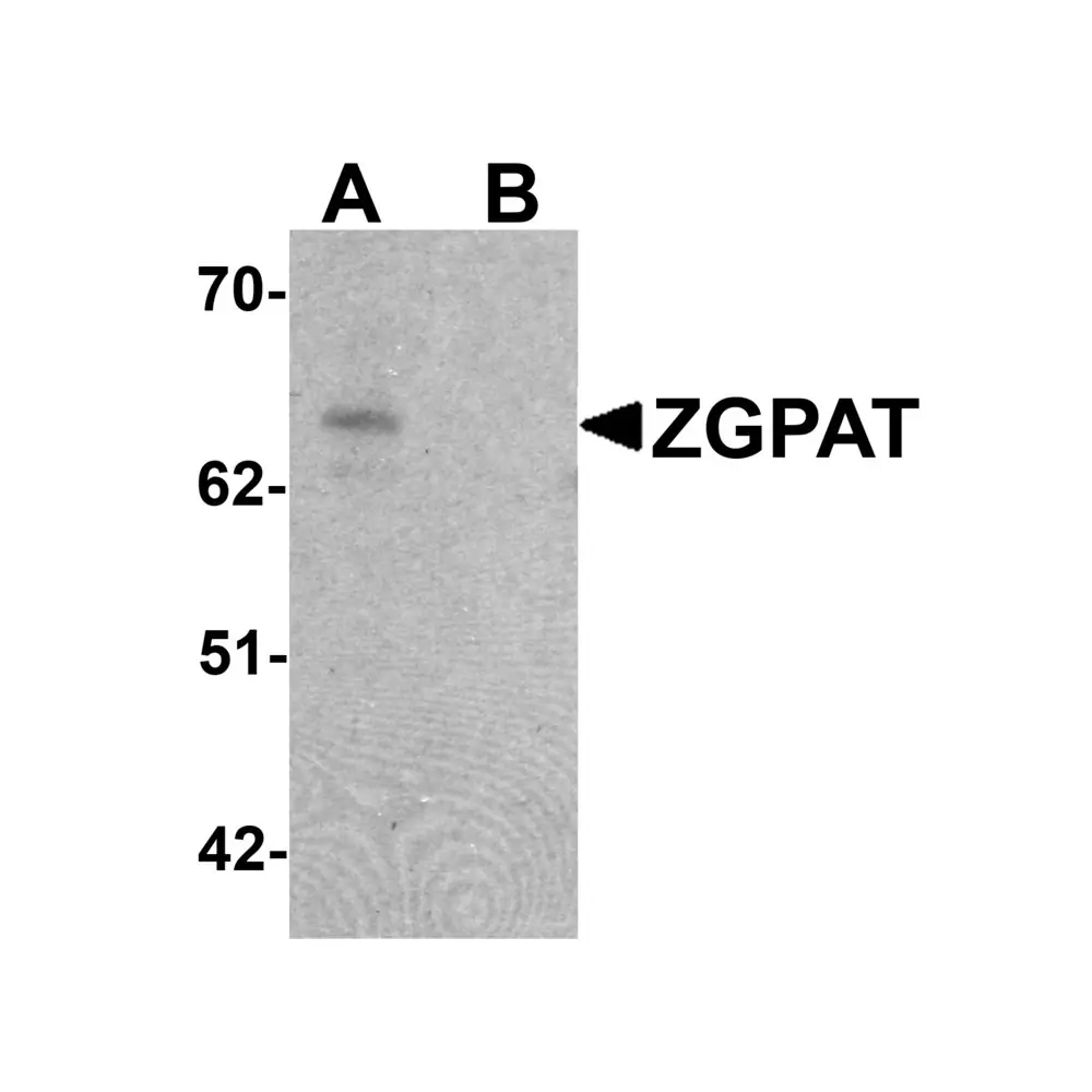 ProSci 6611 ZGPAT Antibody, ProSci, 0.1 mg/Unit Primary Image