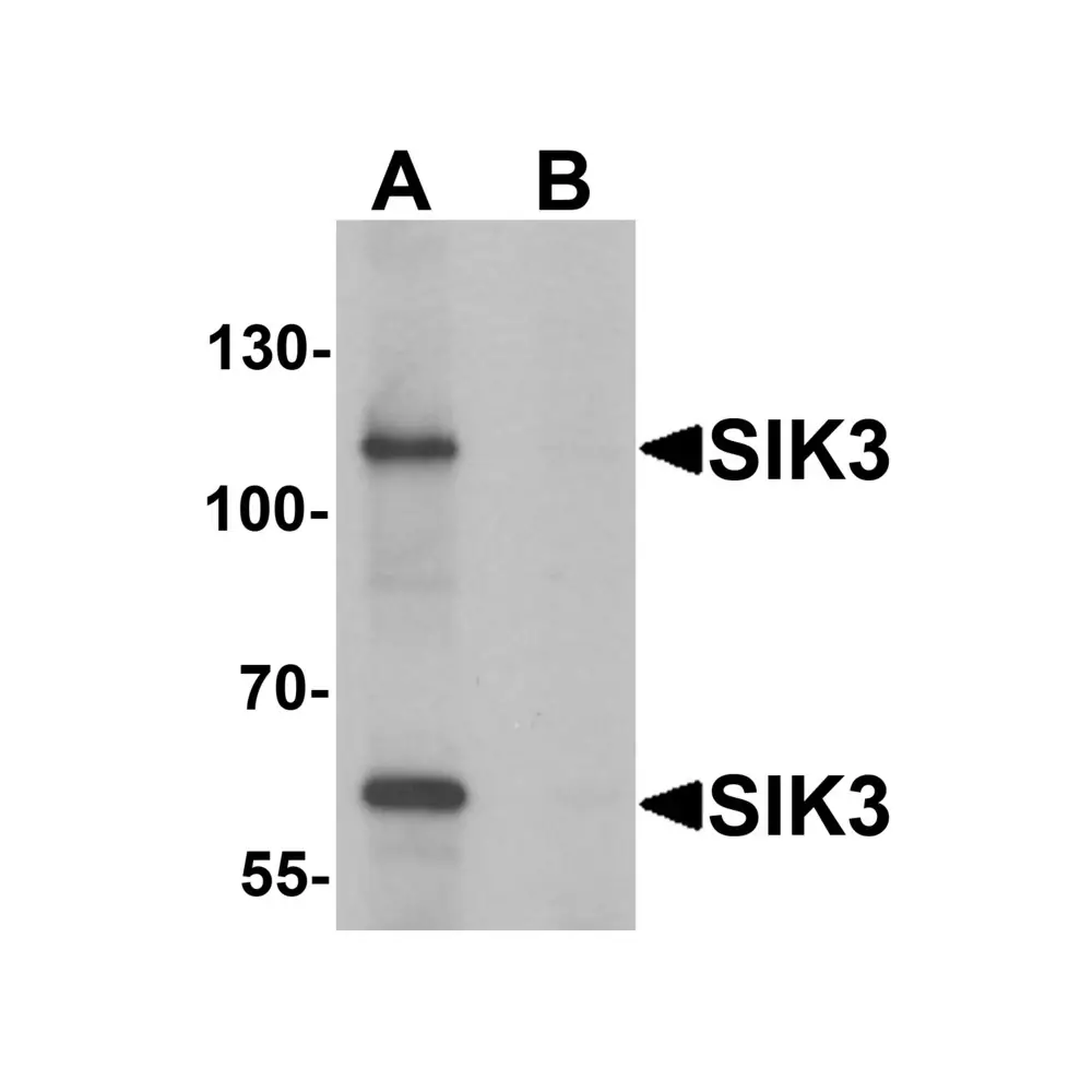 ProSci 6613 SIK3 Antibody, ProSci, 0.1 mg/Unit Primary Image
