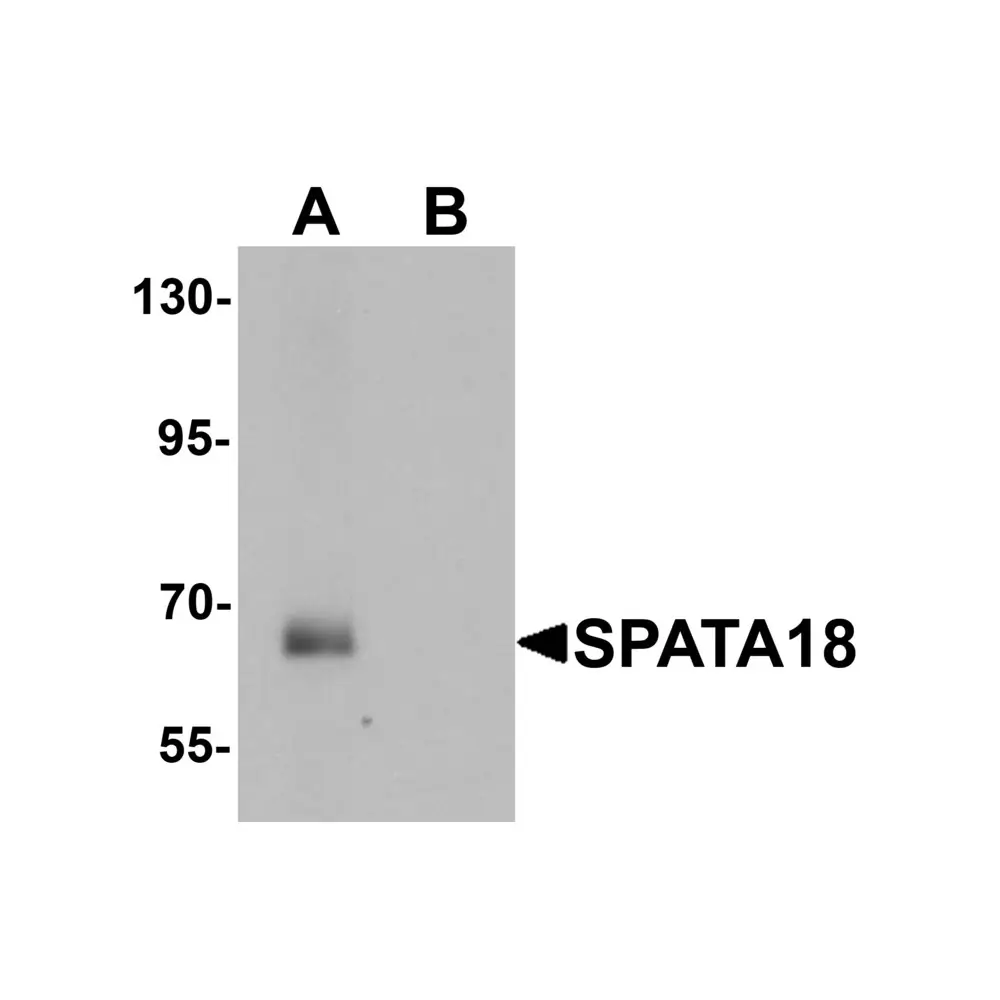 ProSci 6615 SPATA18 Antibody, ProSci, 0.1 mg/Unit Primary Image