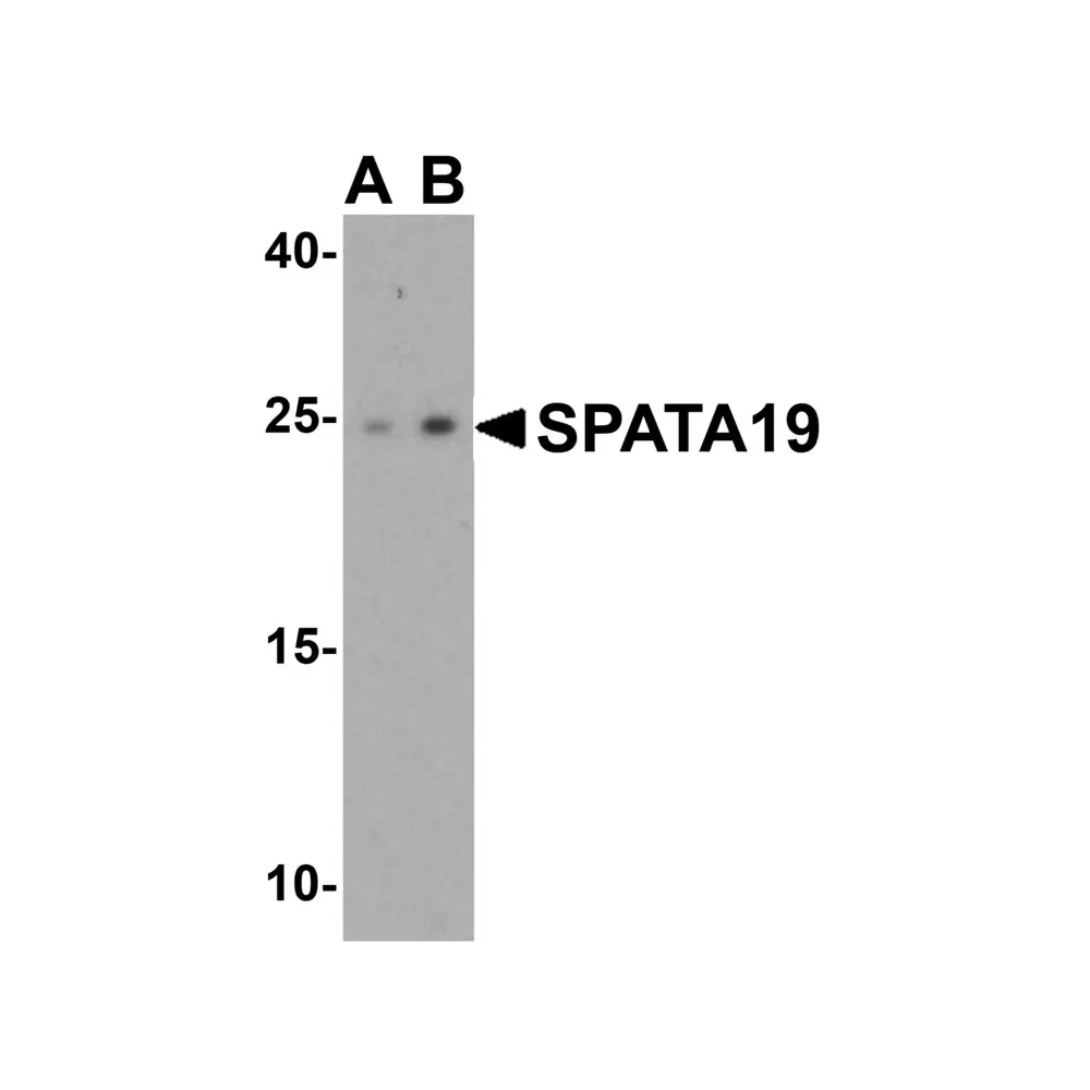 ProSci 6617 SPATA19 Antibody, ProSci, 0.1 mg/Unit Primary Image
