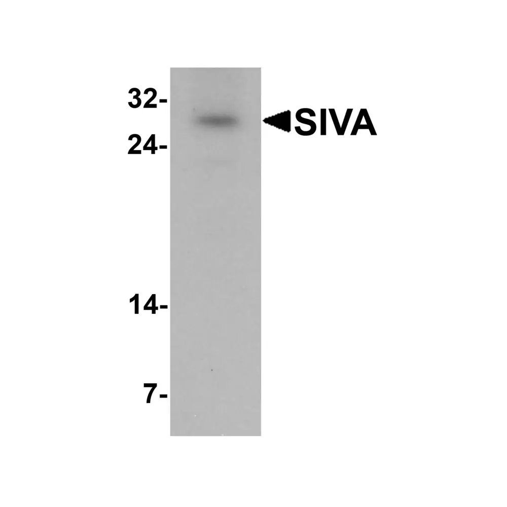 ProSci 6621_S SIVA Antibody, ProSci, 0.02 mg/Unit Primary Image