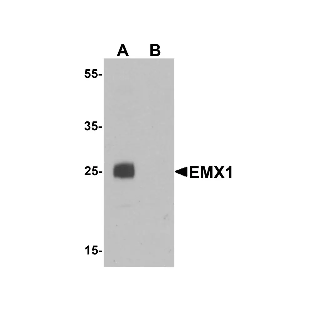 ProSci 6625 EMX1 Antibody, ProSci, 0.1 mg/Unit Primary Image