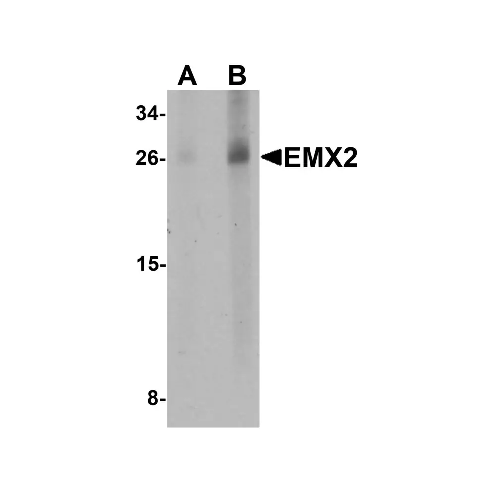 ProSci 6627 EMX2 Antibody, ProSci, 0.1 mg/Unit Primary Image
