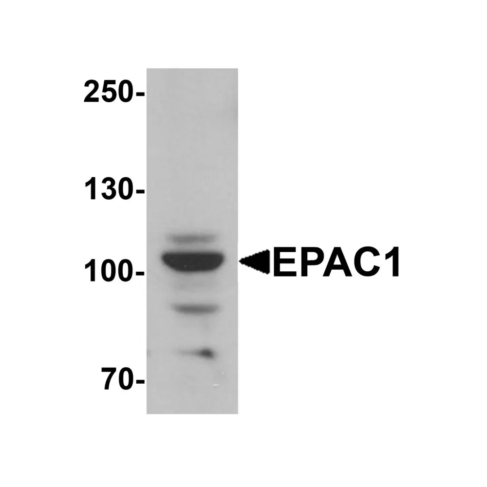 ProSci 6631 EPAC1 Antibody, ProSci, 0.1 mg/Unit Primary Image