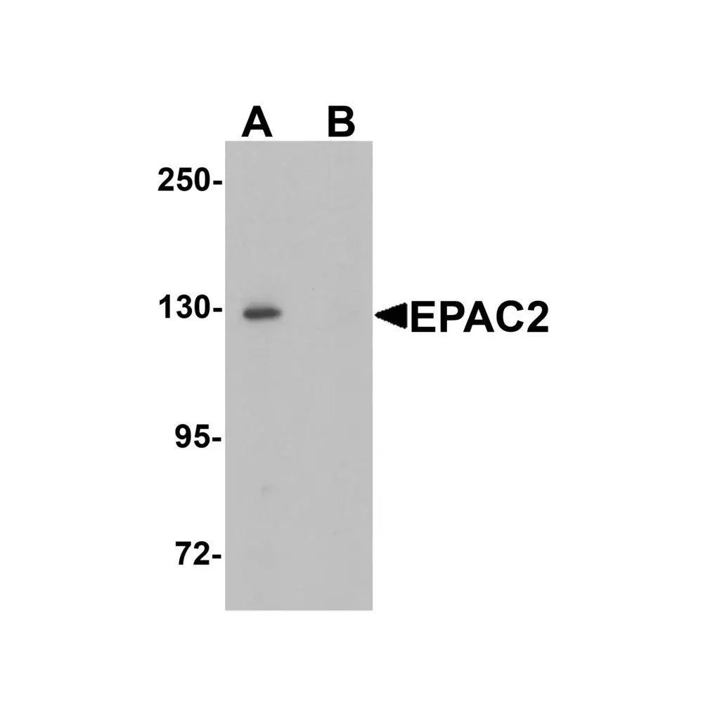 ProSci 6633 EPAC2 Antibody, ProSci, 0.1 mg/Unit Primary Image