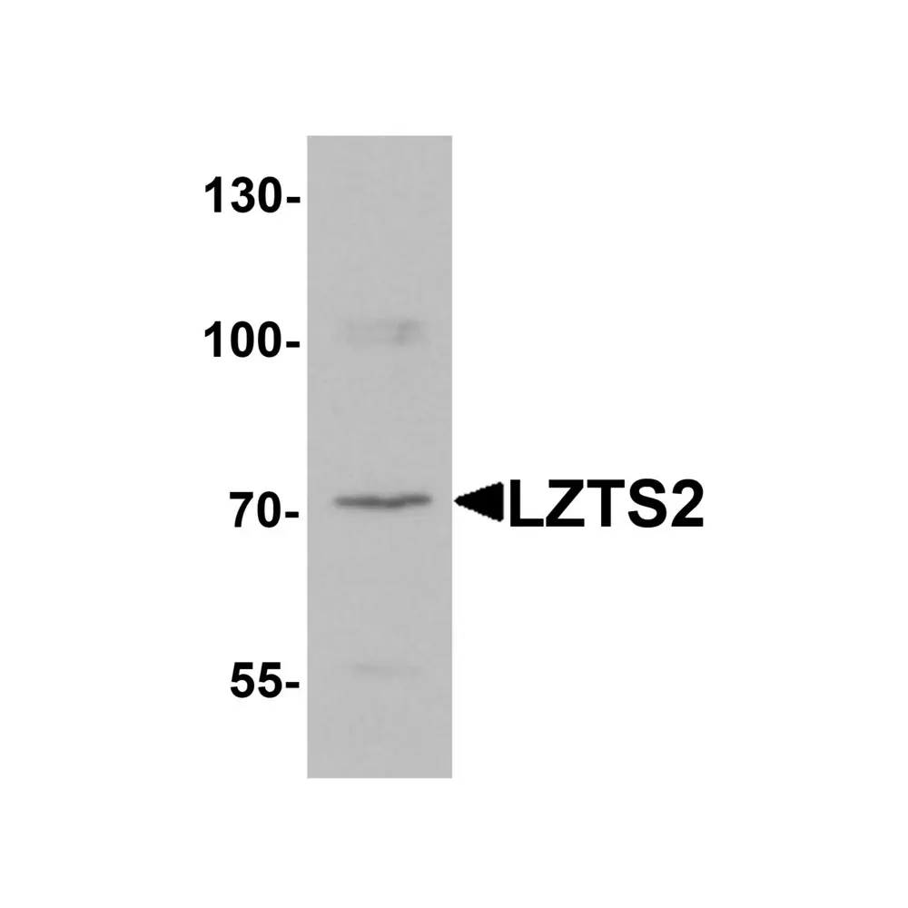 ProSci 6635 LZTS2 Antibody, ProSci, 0.1 mg/Unit Primary Image