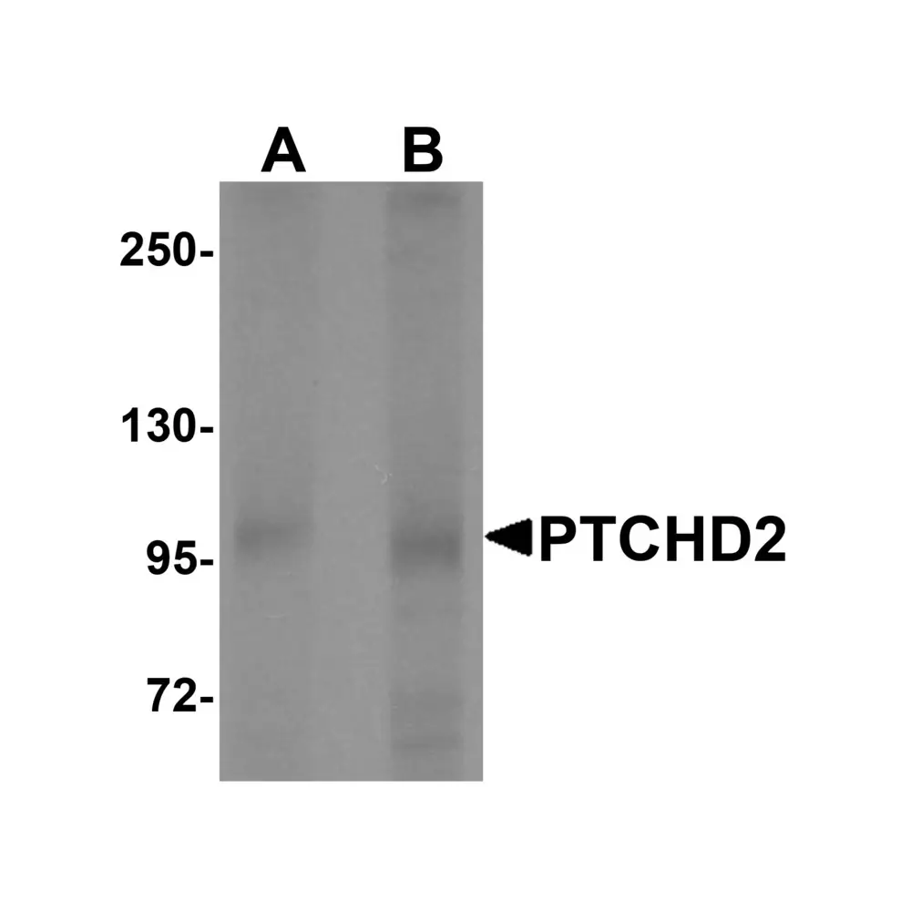 ProSci 6637 PTCHD2 Antibody, ProSci, 0.1 mg/Unit Primary Image