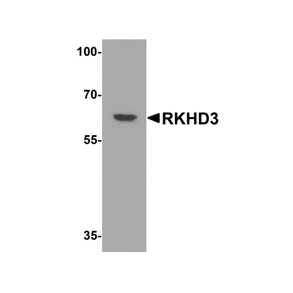 ProSci 6641_S RKHD3 Antibody, ProSci, 0.02 mg/Unit Primary Image