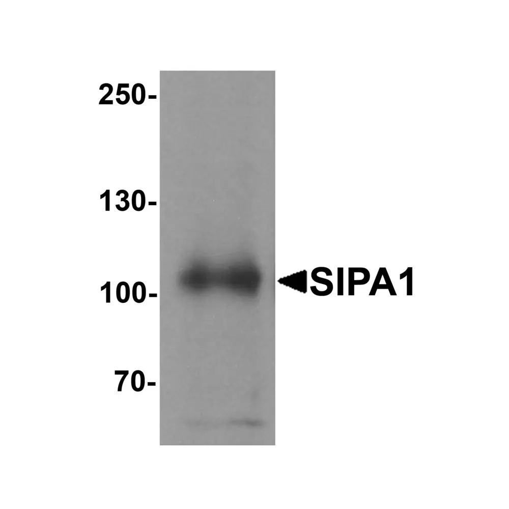 ProSci 6643 SIPA1 Antibody, ProSci, 0.1 mg/Unit Primary Image
