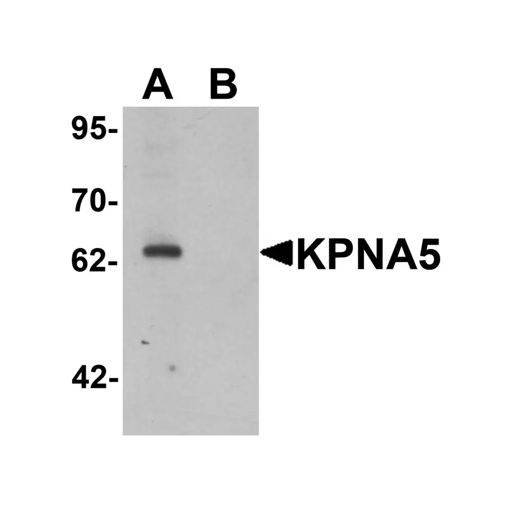 ProSci 6655 KPNA5 Antibody, ProSci, 0.1 mg/Unit Primary Image