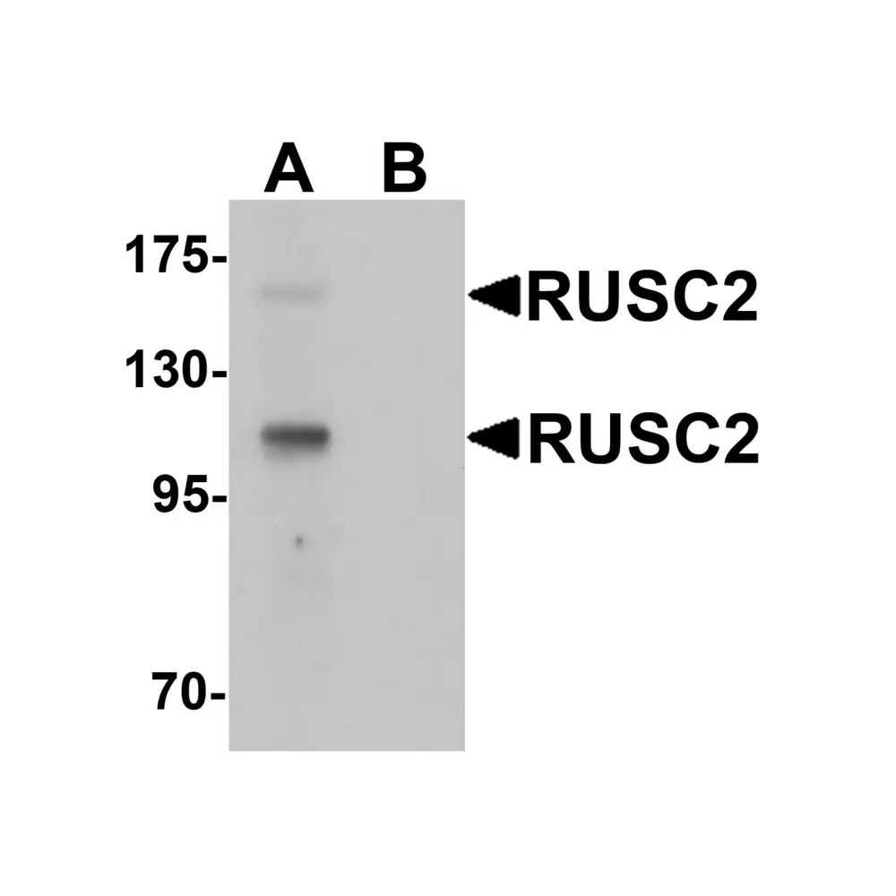 ProSci 6659 RUSC2 Antibody, ProSci, 0.1 mg/Unit Primary Image