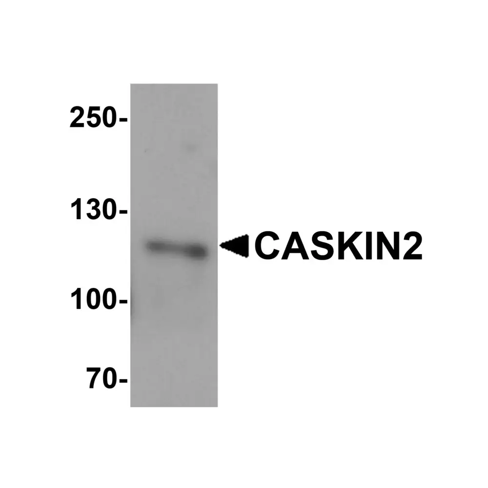 ProSci 6663 CASKIN2 Antibody, ProSci, 0.1 mg/Unit Primary Image